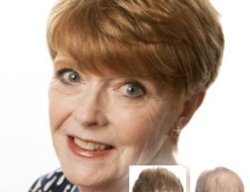 Women’s Hair Replacement