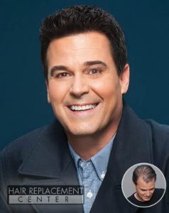 Hair Replacement Center - Men's Hair Replacement Men's Non-Surgical Hair Replacement from HRC of Iowa