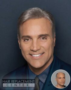Men's Non-Surgical Hair Replacement at Hair Replacement Center of Iowa featuring OnRite from HairVisions International Men's Non-Surgical Hair Replacement Solutions from Hair Replacement Center of Iowa