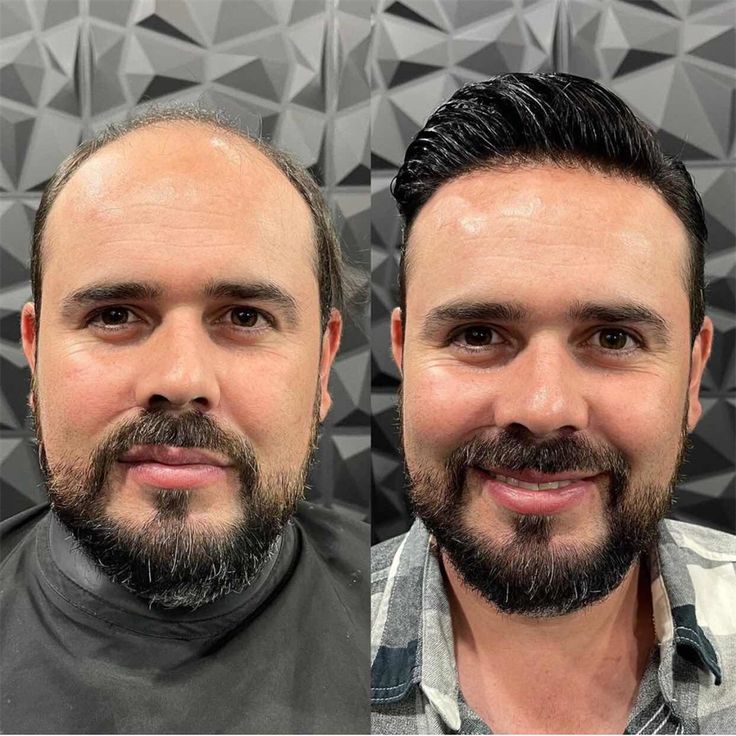 toupee - hair pieces for men toupee - hair pieces for men