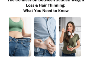 The Connection Between Sudden Weight Loss & Hair Thinning: What You Need to Know