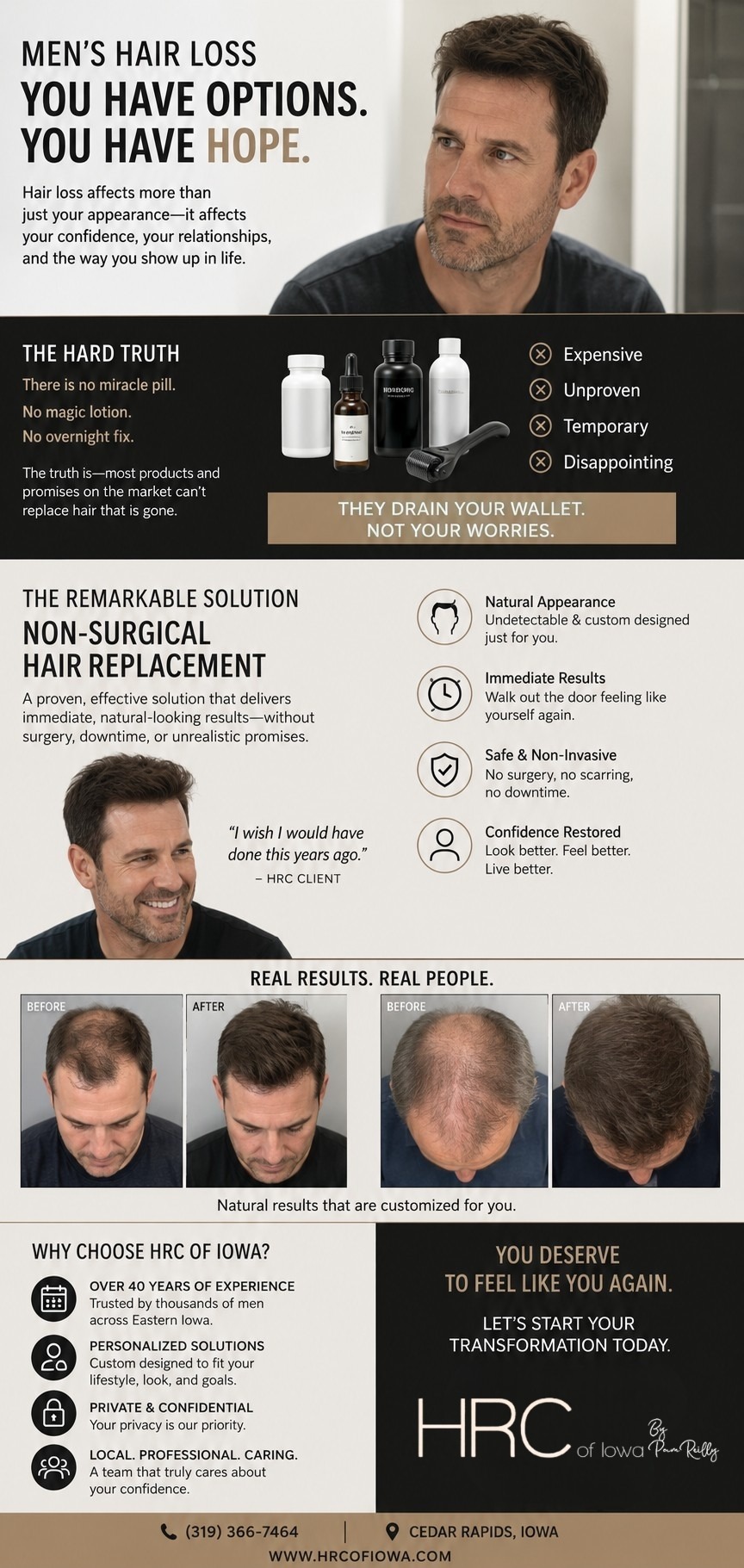 Men's Hair Loss Solutions in Cedar Rapids Why Non-Surgical Hair Replacement Works